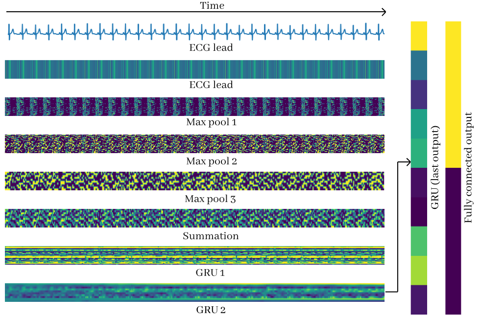 Activation patterns showing spiking behavior across different network layers during ECG-based sleep classification.